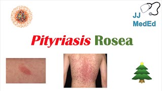 Polycythemia Rubra Vera  Pathophysiology Symptoms Diagnosis and Treatment [upl. by Gilead567]