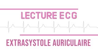 Interprétation ECG  Extrasystole Auriculaire quotESAquot [upl. by Peednama]