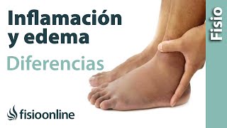 Inflamación y edema  Diferencias y características [upl. by Anayia993]