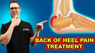 Heel Bursitis  Causes and Treatment [upl. by Aslehc]