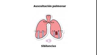 Ruidos respiratorios agregados  Sibilancias [upl. by Maghutte]