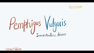 Pemphigus Vulgaris  clinical features pathophysiology and histology  immunobullous skin disease [upl. by Bordie194]