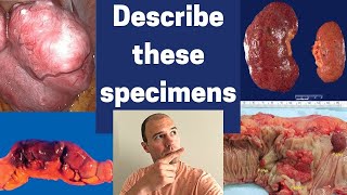 How to describe gross pathology specimens [upl. by Yuri]