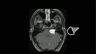 Cranial nerve VIII [upl. by Arbba564]