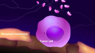 Introduction to Cancer Biology Part 3 Tissue Invasion and Metastasis [upl. by Wrench]