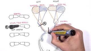 Visual Pathway and Lesions [upl. by Thirza]