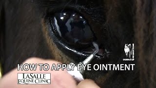 CataractCoach 1038 recurrent pterygium surgery [upl. by Karlise]