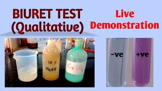 Biuret test  Biochemistry [upl. by Asilrak]