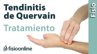 Tendinitis de De Quervain  Tratamiento con ejercicios automasajes y estiramientos [upl. by Diraf]