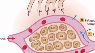 Mechanisms of edema development [upl. by Anilatac]