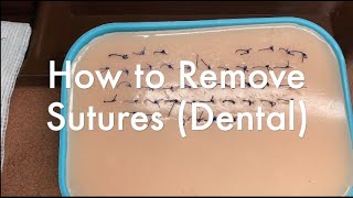 How to Remove Sutures Dental Suture Removal [upl. by Levenson546]