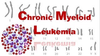 Chronic Myeloid Leukemia  CML  Philadelphia Chromosome [upl. by Nitfa]