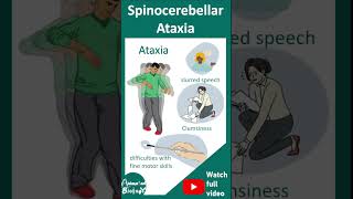 Spinocerebellar ataxia SCA  pathology diagnosis and treatment  1 minute pathology [upl. by Nifares]