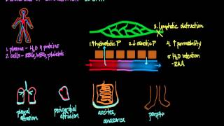 Disorders of Circulation Edema [upl. by Jessalyn865]