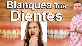 COMO BLANQUEAR LOS DIENTES EN MINUTOS  5 Remedios Caseros Para Blanquear Los Dientes Naturalmente [upl. by Asnarepse]