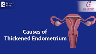 What causes Endometrial thickness  DrSmitha Sha of Cloudnine Hospitals  Doctors Circle [upl. by Nomma606]