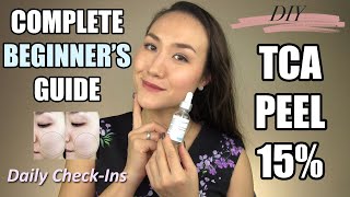 TCA PEEL DIY Application Tips Before amp After Results At Home  Guide for BEGINNERS [upl. by Uhej985]