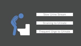 Finding it Difficult to Urinate  Fairbanks Urology  Dr Tony Nimeh Urologist [upl. by Ahsenar]