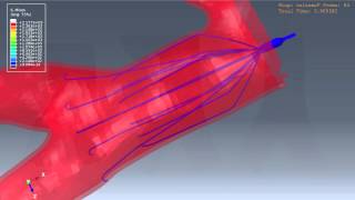 IVC Ultrasound for Fluid Responsiveness [upl. by Josee]