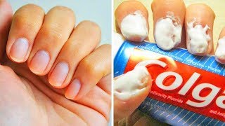 20 ASTUCES FACILES POUR DES ONGLES PARFAITS [upl. by Laszlo293]