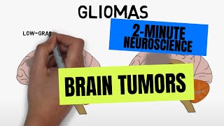 2Minute Neuroscience Brain tumors [upl. by Marjy523]