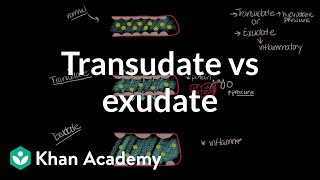 Transudate vs exudate  Respiratory system diseases  NCLEXRN  Khan Academy [upl. by Nanaek649]