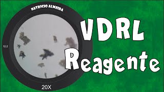 Teste de VDRL Reagente  Visto ao microscópio [upl. by Case]