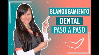 Blanqueamiento Dental Paso a Paso  Doctora Verónica [upl. by Thevenot]