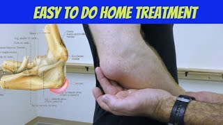 Hip Bursitis Treatment Drug free amp NonInvasive [upl. by Isadore]