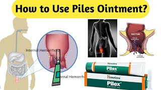 How to Use Piles Ointment [upl. by Aznaed]