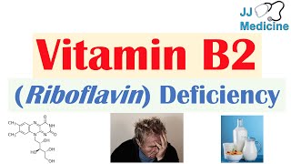 Vitamin B2 Riboflavin Deficiency  Food Sources Causes Symptoms Diagnosis and Treatment [upl. by Cornall504]