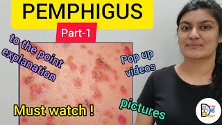 SKIN LESIONS PEMPHIGUS PART1 [upl. by Nesiaj]