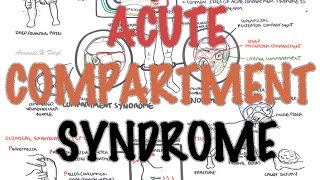 Compartment Syndrome  Overview signs and symptoms pathophysiology treatment [upl. by Koehler]