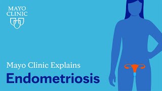 Mayo Clinic Explains Endometriosis [upl. by Aralc388]