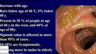 CLINIC How to heal Diverticulitis naturally [upl. by Leunammi]