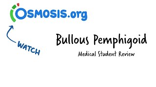 Bullous Pemphigoid Osmosis Study Video [upl. by Rosalia57]