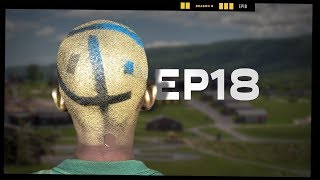 Bad Hair Day  EP18  Camp Woodward Season 9 [upl. by Farrica]